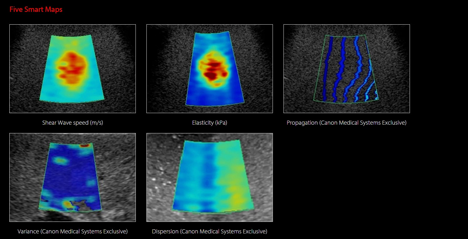 Aplio i series shear wave 2