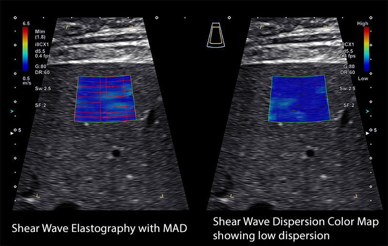 Aplio i series szoveti merevseg foto